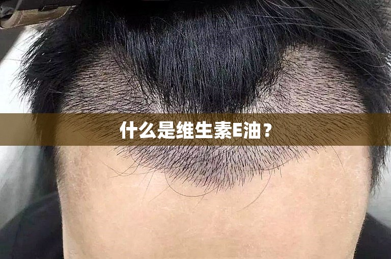 什么是维生素E油？