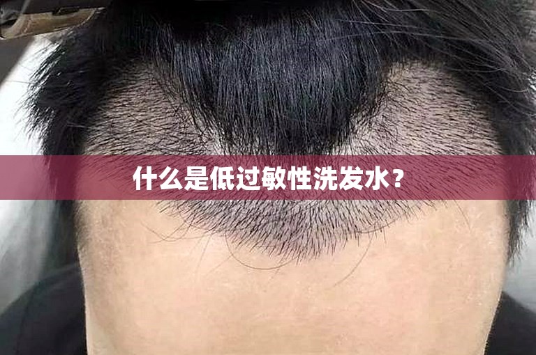 什么是低过敏性洗发水？