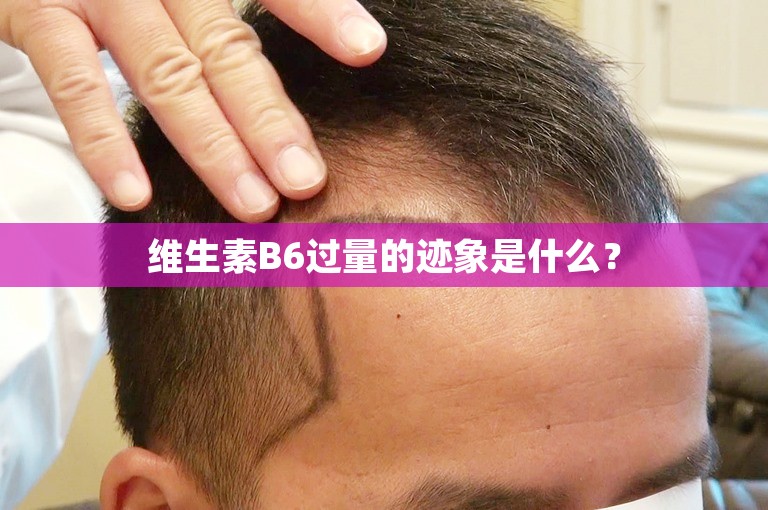 维生素B6过量的迹象是什么？