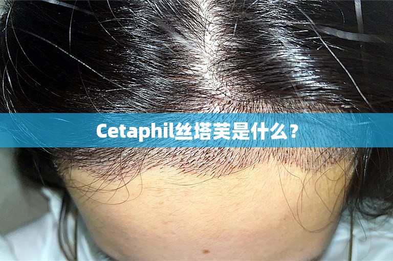 Cetaphil丝塔芙是什么？