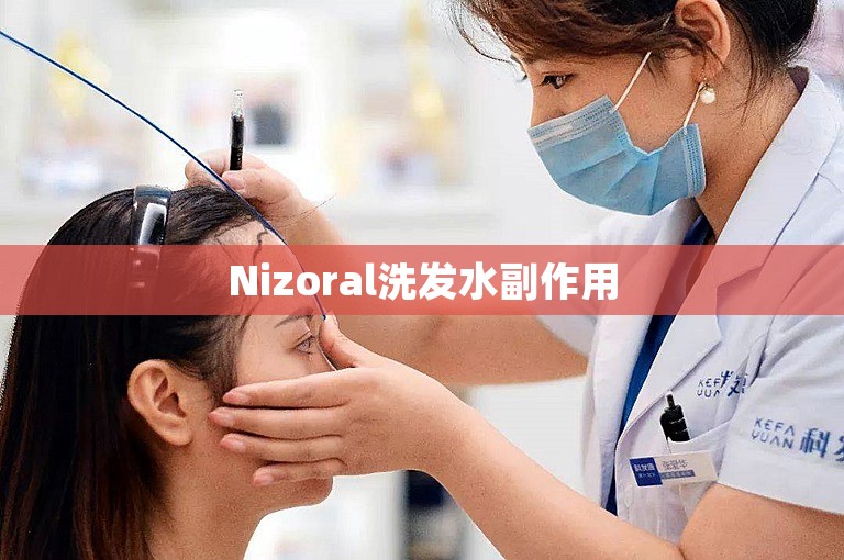 Nizoral洗发水副作用