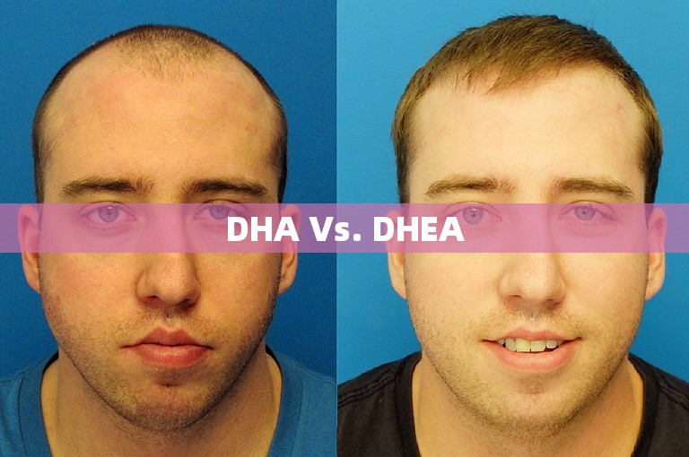 DHA Vs. DHEA