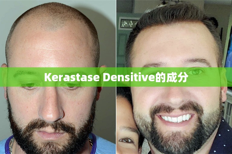 Kerastase Densitive的成分