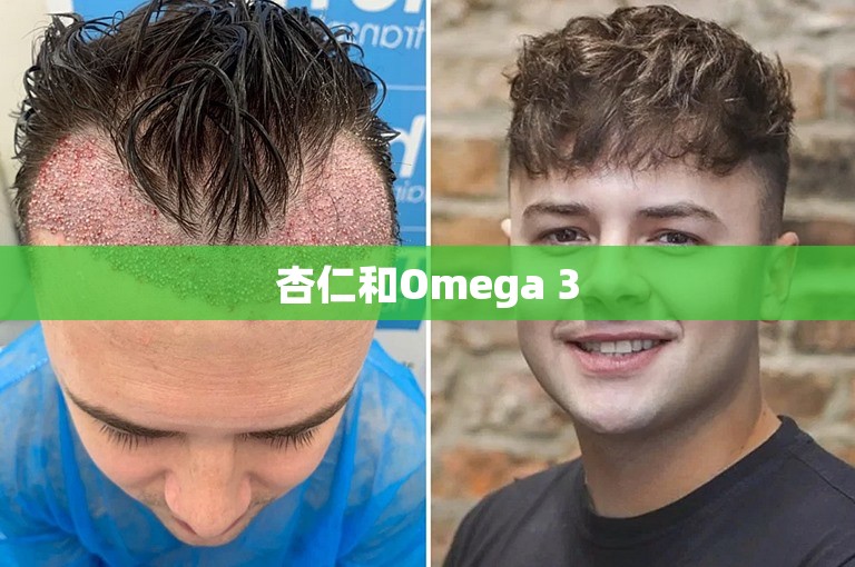 杏仁和Omega 3