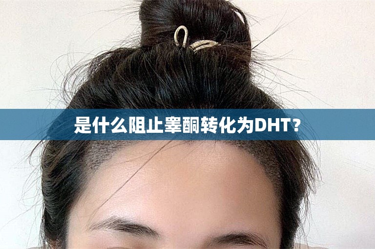 是什么阻止睾酮转化为DHT？