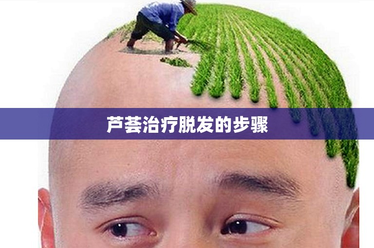 芦荟治疗脱发的步骤