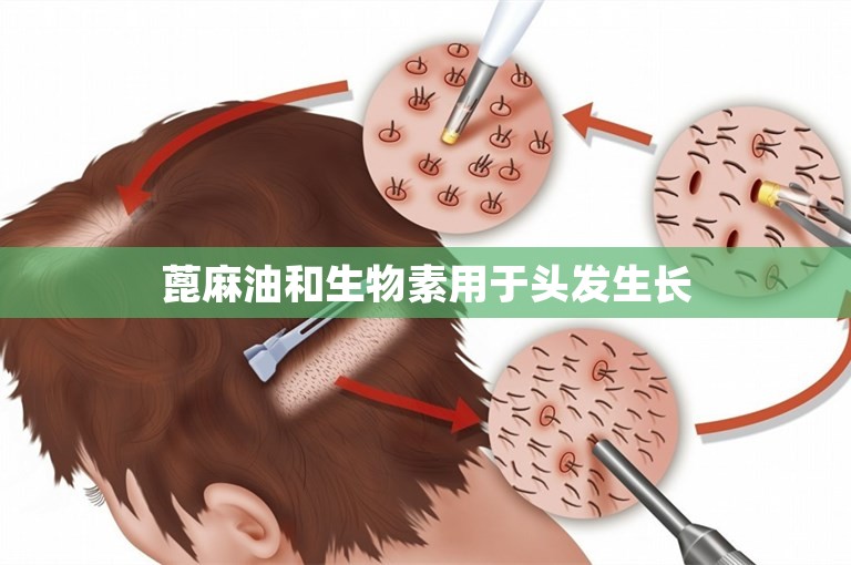 蓖麻油和生物素用于头发生长