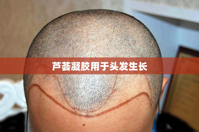 芦荟凝胶用于头发生长