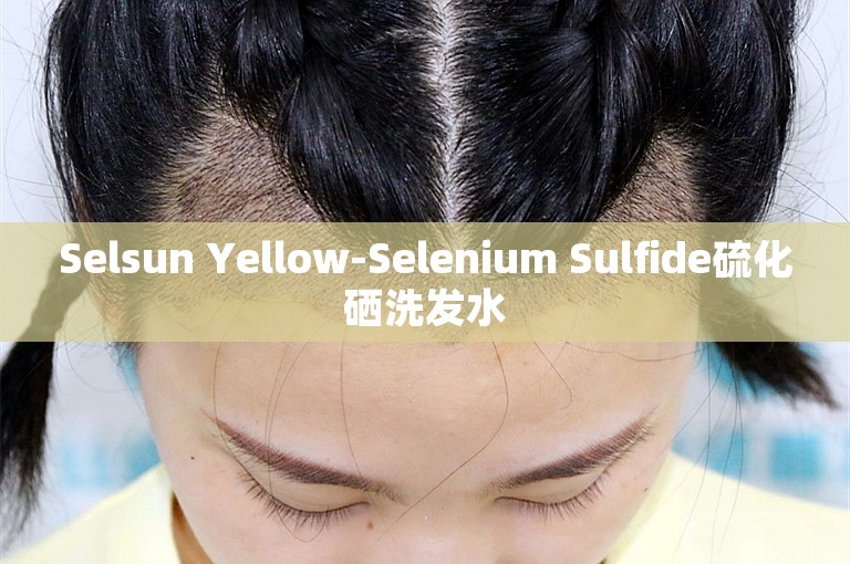 Selsun Yellow-Selenium Sulfide硫化硒洗发水