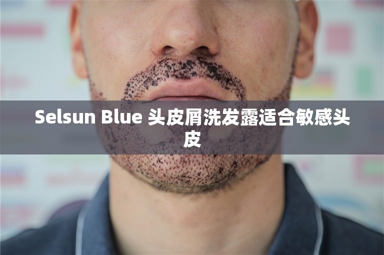 Selsun Blue 头皮屑洗发露适合敏感头皮