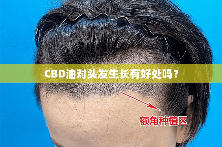 CBD油对头发生长有好处吗？