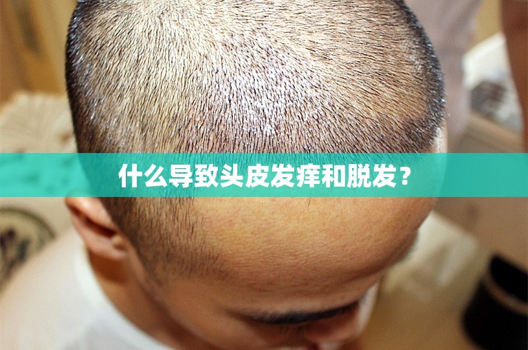 什么导致头皮发痒和脱发？