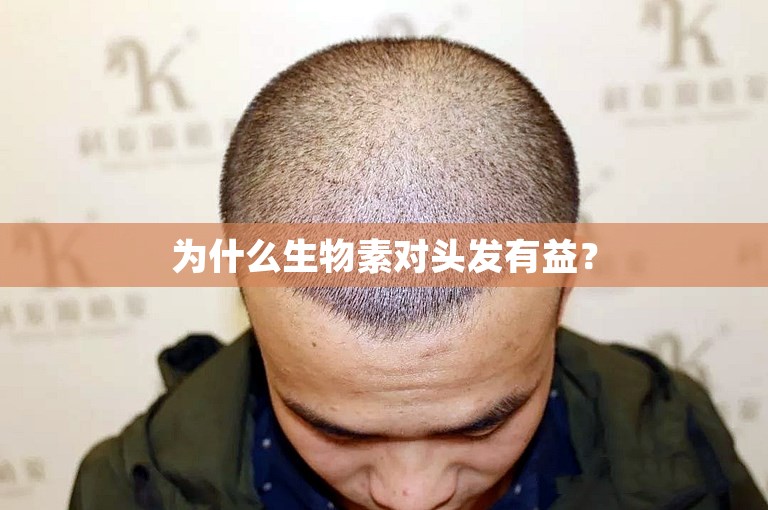 为什么生物素对头发有益？