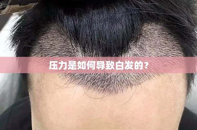 压力是如何导致白发的？