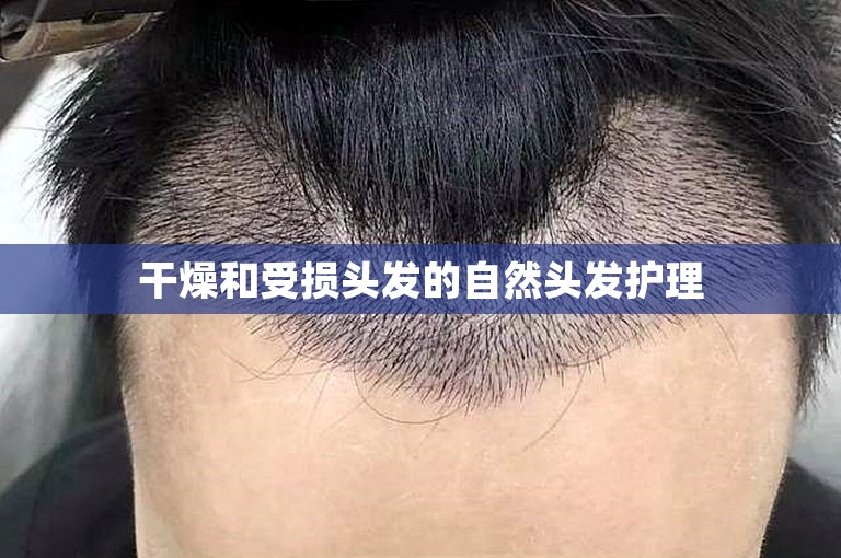 干燥和受损头发的自然头发护理