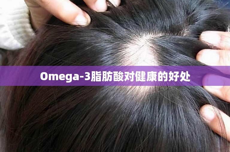 Omega-3脂肪酸对健康的好处