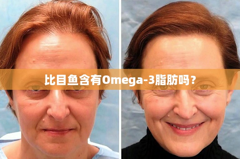 比目鱼含有Omega-3脂肪吗？