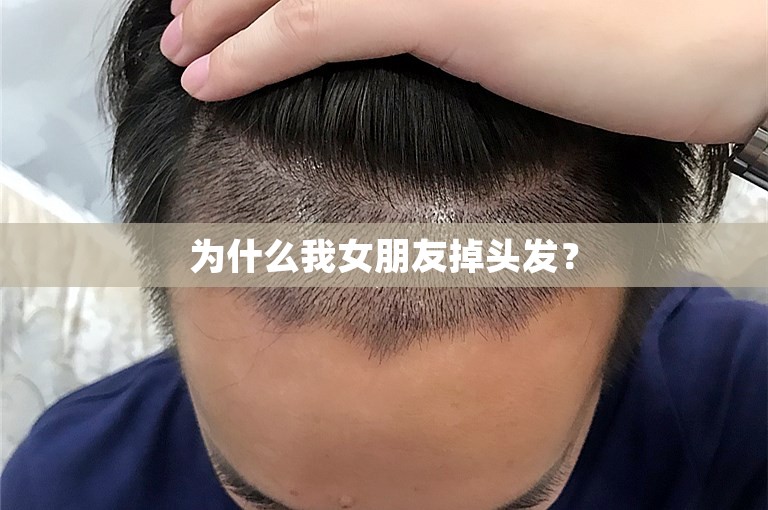 为什么我女朋友掉头发？