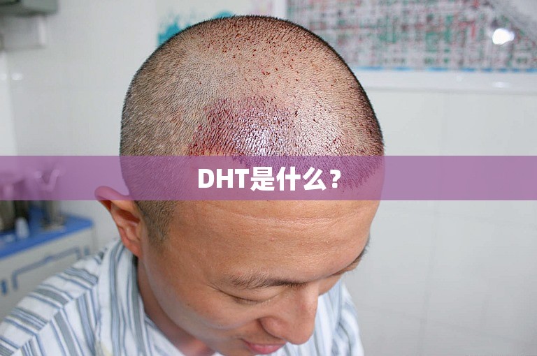 DHT是什么？