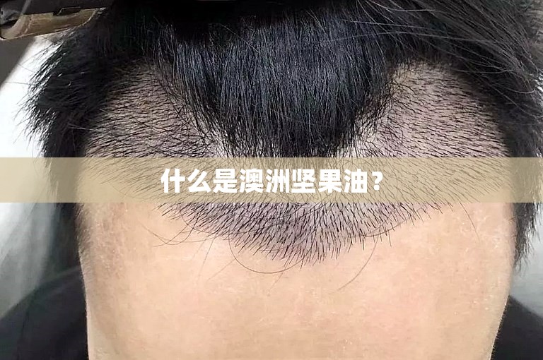 什么是澳洲坚果油？