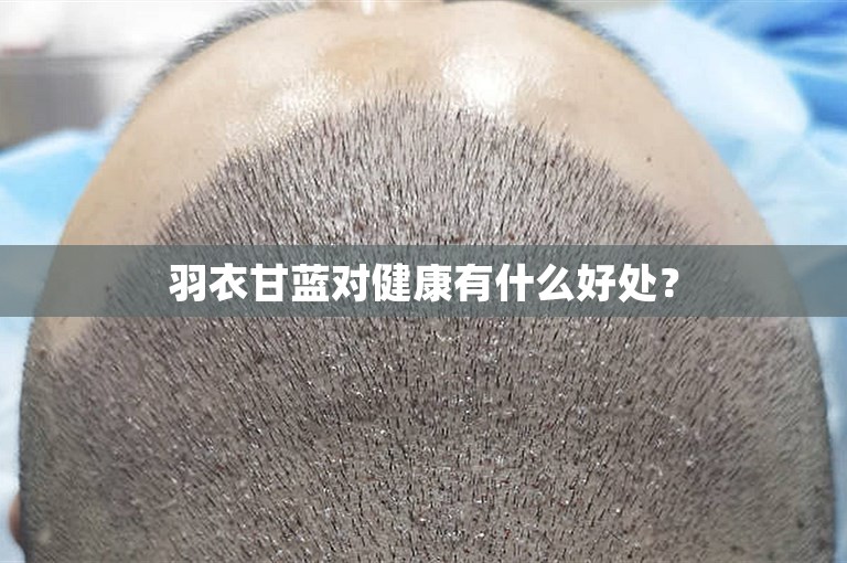 羽衣甘蓝对健康有什么好处？