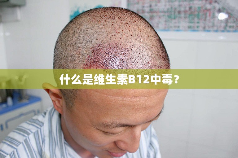 什么是维生素B12中毒？