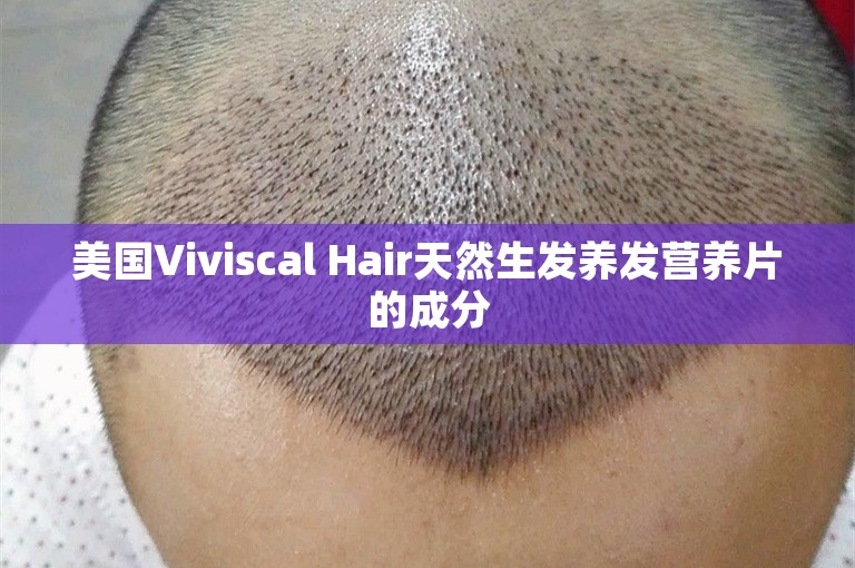 美国Viviscal Hair天然生发养发营养片的成分