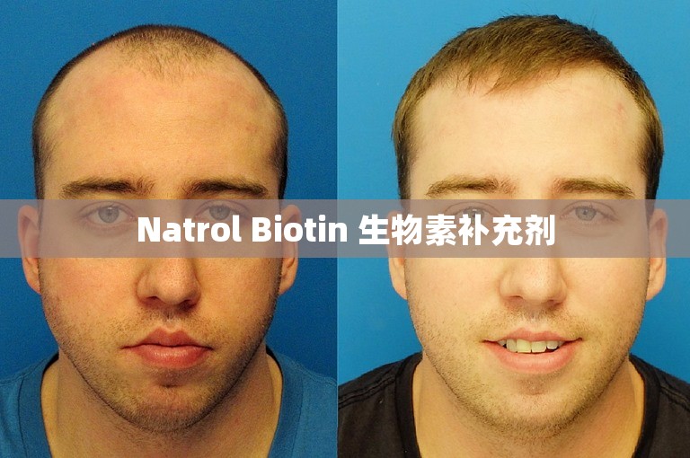 Natrol Biotin 生物素补充剂