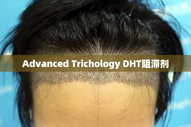 Advanced Trichology DHT阻滞剂