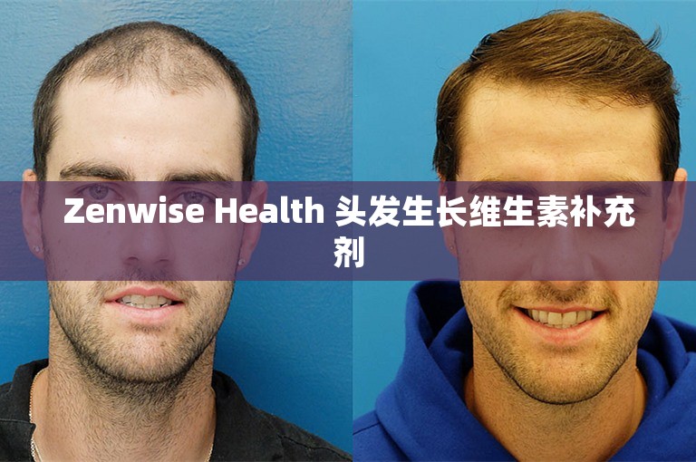 Zenwise Health 头发生长维生素补充剂