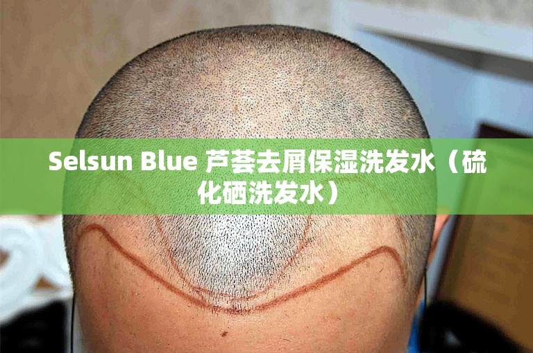 Selsun Blue 芦荟去屑保湿洗发水（硫化硒洗发水）