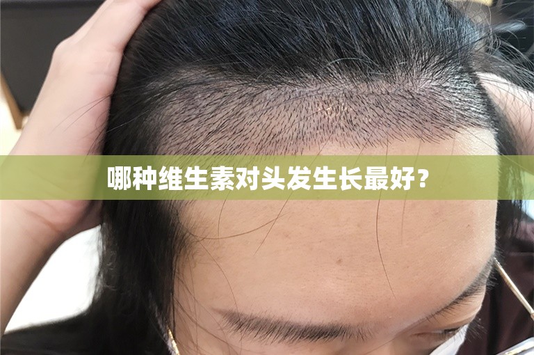 哪种维生素对头发生长最好？