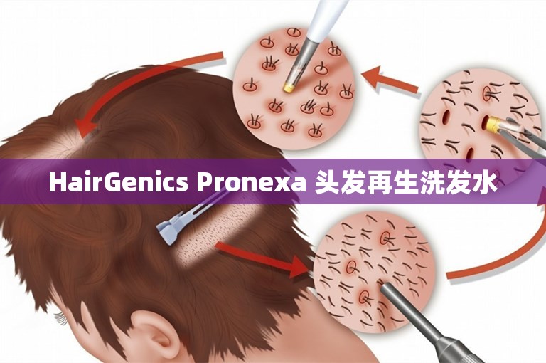 HairGenics Pronexa 头发再生洗发水