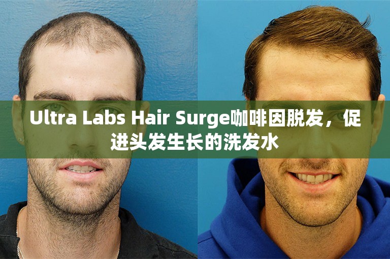 Ultra Labs Hair Surge咖啡因脱发，促进头发生长的洗发水