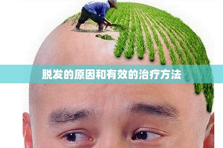 脱发的原因和有效的治疗方法