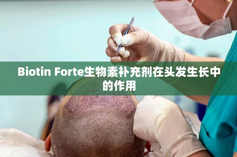 Biotin Forte生物素补充剂在头发生长中的作用