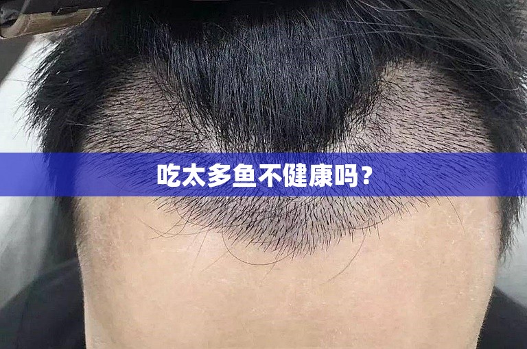 吃太多鱼不健康吗？