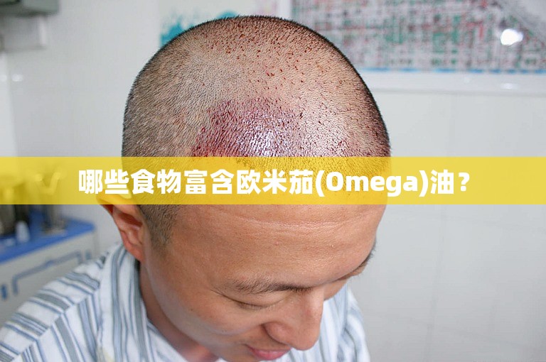 哪些食物富含欧米茄(Omega)油？