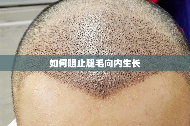 如何阻止腿毛向内生长