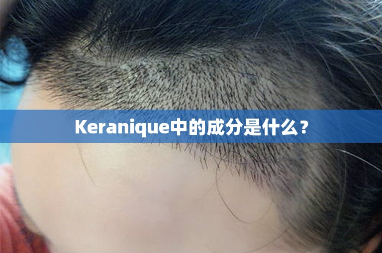 Keranique中的成分是什么？