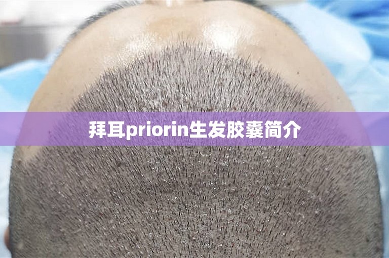 拜耳priorin生发胶囊简介