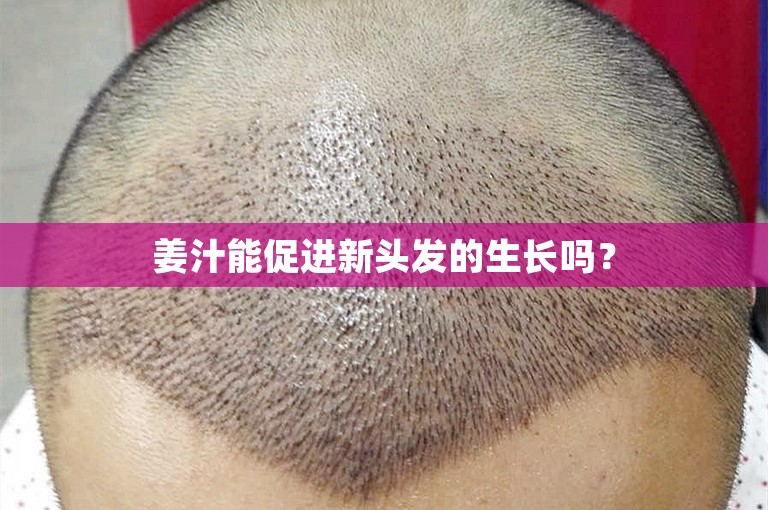 姜汁能促进新头发的生长吗？