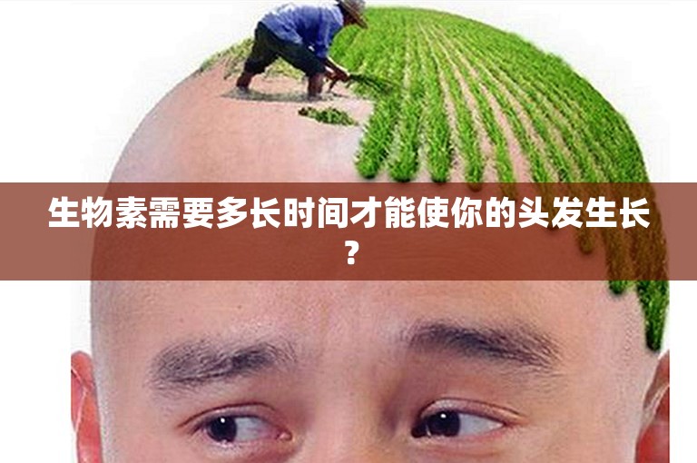 生物素需要多长时间才能使你的头发生长？