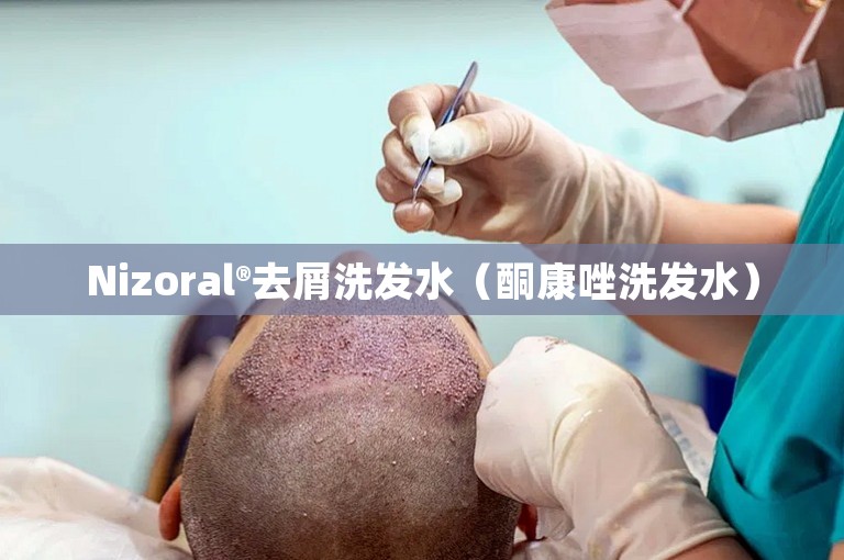 Nizoral®去屑洗发水（酮康唑洗发水）