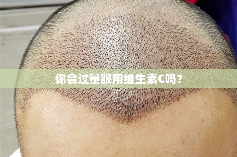 你会过量服用维生素C吗？