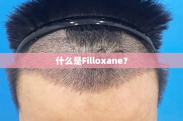 什么是Filloxane？