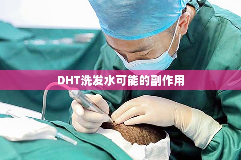 DHT洗发水可能的副作用