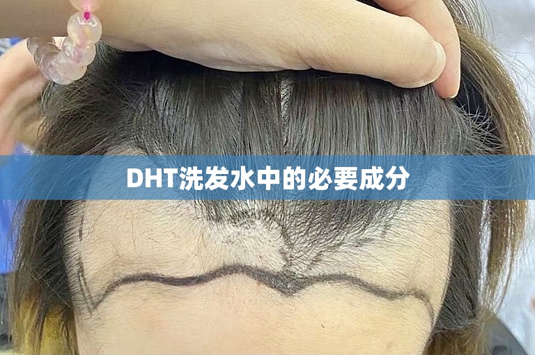 DHT洗发水中的必要成分