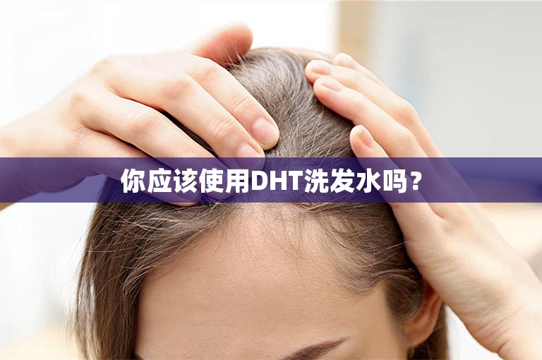 你应该使用DHT洗发水吗？