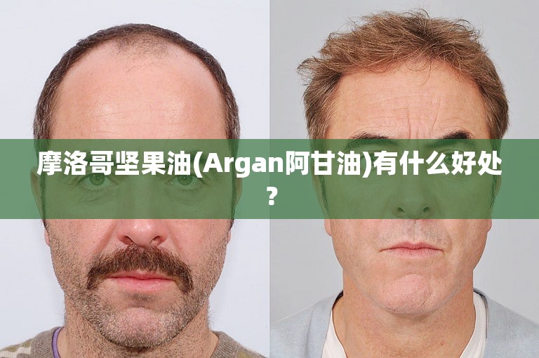 摩洛哥坚果油(Argan阿甘油)有什么好处？